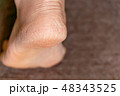 中高年女性のかかと ひび割れ 角化症の写真素材