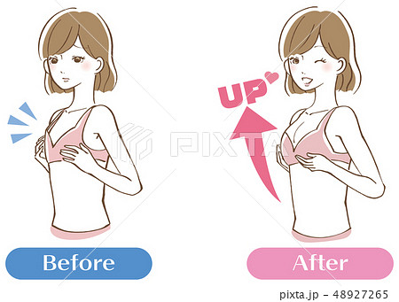breast enlargement Illustrations - PIXTA