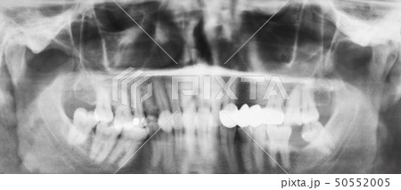 デンタル 歯科 骨格 X線の写真素材 - PIXTA