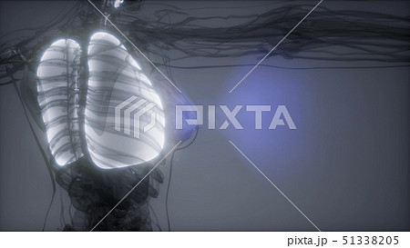 胸部 レントゲン 女性 胸の写真素材 - PIXTA