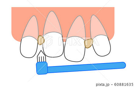前歯のイラスト素材