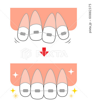 前歯のイラスト素材