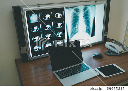 胸部 レントゲン Ct 検査の写真素材