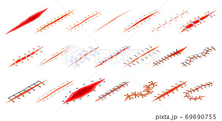 縫合 傷 キズ 跡のイラスト素材