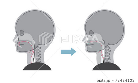 嚥下訓練のイラスト素材