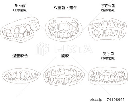 しゃくれのイラスト素材