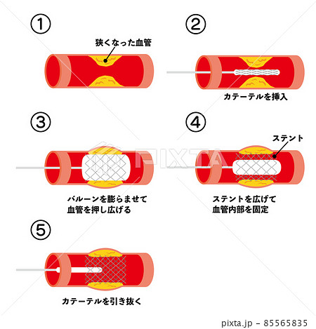 心臓のイラスト素材集 ピクスタ