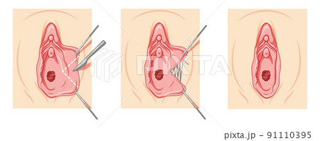 female pelvic girdle Diagram